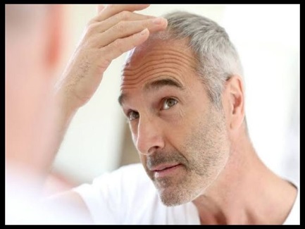 سفیدی مو نتیجه کاشت مو رو تحت تاثیر قرار میده؟